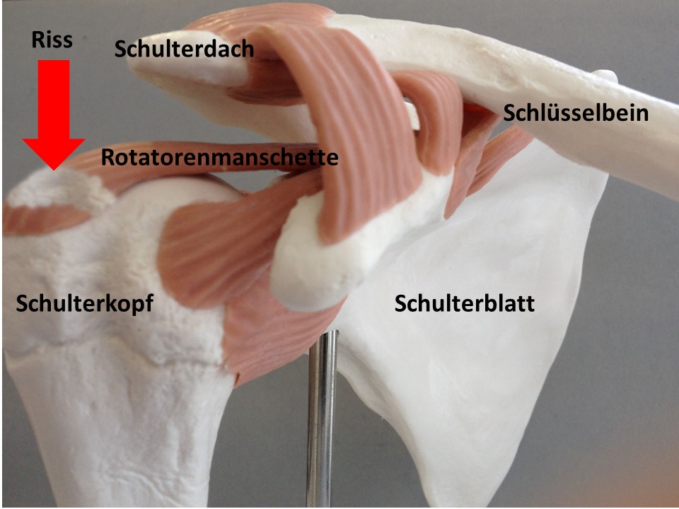 Rotatorenmanschette Anatomie Bilder JMJNR